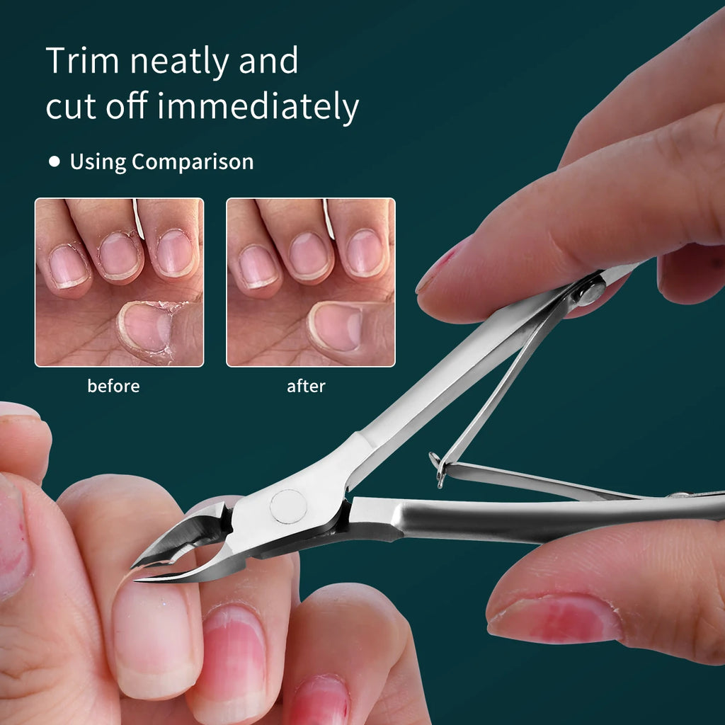 Set profesional de cortacutículas: tijeras ultraafiladas para piel muerta (manicura y pedicura para hombres y mujeres), herramienta ergonómica de fácil uso.