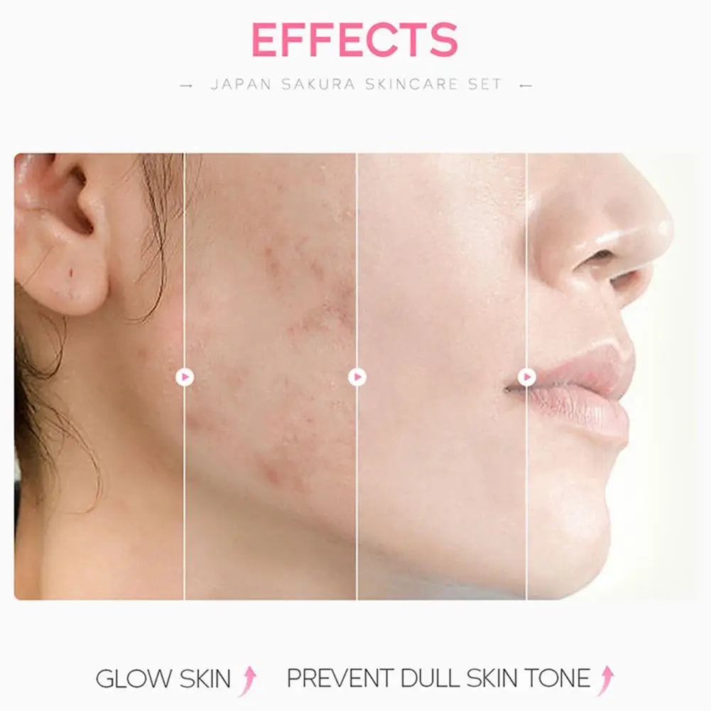 Set de 3 o 5 piezas para el cuidado de la piel con extracto de Sakura: incluye crema facial, sérum, tónico, limpiador facial, protector solar y crema para el contorno de ojos; presentado en caja de regalo.